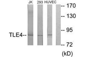 Western blot analysis of extracts from Jurkat/293/HuvEc cells, using TLE4 Antibody. (TLE4 anticorps  (AA 161-210))