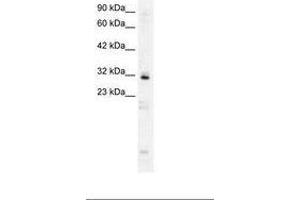 Image no. 2 for anti-Homeobox B9 (HOXB9) (AA 67-116) antibody (ABIN6735813)