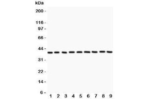 Western blot testing of APE1 antibody and Lane 1:  rat NRK;  2: human HeLa;  3: (r) PC12;  4: (r) RH35;  5: mouse HEPA;  6: (h) MCF7: (h) A549;  8: (h) placenta;  9: (h) A431. (APEX1 anticorps  (AA 2-318))
