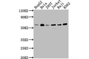 Western Blot Positive WB detected in: HepG2 whole cell lysate, Hela whole cell lysate, 293T whole cell lysate, Jurkat whole cell lysate, Raji whole cell lysate, K562 whole cell lysate All lanes: TRAF2 antibody at 1:1500 Secondary Goat polyclonal to rabbit IgG at 1/50000 dilution Predicted band size: 56, 62, 55, 54 kDa Observed band size: 56 kDa (Recombinant TRAF2 anticorps)