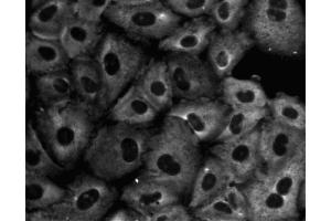 Immunofluorescent staining of A549 (ATCC CCL-185) cells. (GNB2L1 anticorps  (AA 113-317))