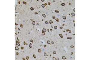 Immunohistochemistry of paraffin-embedded mouse brain using IRF1 antibody. (IRF1 anticorps)