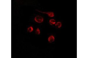 ABIN6275180 staining Hela by IF/ICC. (GNL1 anticorps)