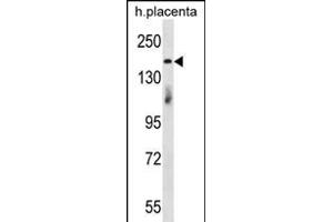 INTS1 Antibody (ABIN656190 and ABIN2845516) western blot analysis in human placenta tissue lysates (35 μg/lane).