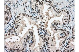 Image no. 9 for anti-Sjogren Syndrome Antigen B (SSB) antibody (ABIN1501146)