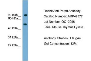 WB Suggested Anti-Parp8 Antibody Titration:  0. (PARP8 anticorps  (C-Term))