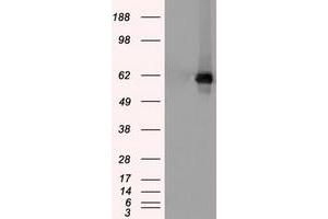 Western Blotting (WB) image for anti-Checkpoint Kinase 2 (CHEK2) antibody (ABIN1497495) (CHEK2 anticorps)