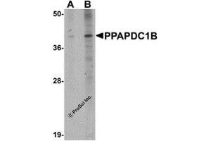 Western Blotting (WB) image for anti-Phosphatidic Acid Phosphatase Type 2 Domain Containing 1B (PPAPDC1B) (N-Term) antibody (ABIN1031523) (PPAPDC1B anticorps  (N-Term))