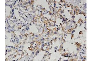 Image no. 1 for anti-Glutaminyl-Peptide Cyclotransferase (QPCT) (AA 262-360) antibody (ABIN599543) (QPCT anticorps  (AA 262-360))