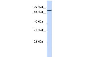 WB Suggested Anti-ASH2L Antibody Titration: 0. (ASH2L anticorps  (N-Term))