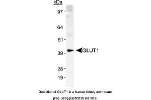 Image no. 2 for anti-Solute Carrier Family 2 (Facilitated Glucose Transporter), Member 1 (SLC2A1) (AA 1-100), (N-Term) antibody (ABIN363548)