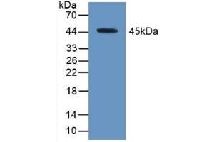 Detection of Recombinant ACAT2, Human using Polyclonal Antibody to Acetyl Coenzyme A Acetyltransferase 2 (ACAT2) (ACAT2 anticorps  (AA 1-397))