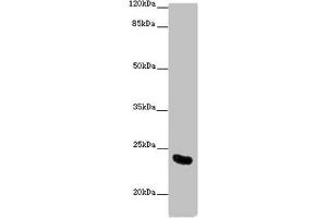 Western blot All lanes: AICDA antibody at 10 μg/mL + Mouse liver tissue Secondary Goat polyclonal to rabbit IgG at 1/10000 dilution Predicted band size: 24, 23 kDa Observed band size: 24 kDa (AICDA anticorps  (AA 1-60))