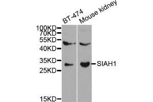 Western blot analysis of extracts of various cell lines, using SIAH1 antibody. (SIAH1 anticorps  (AA 1-313))