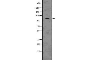 Western blot analysis of MCM5 using HepG2 whole cell lysates (MCM5 anticorps  (N-Term))