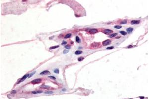 anti-Chemokine (C-C Motif) Receptor 10 (CCR10) (C-Term) antibody