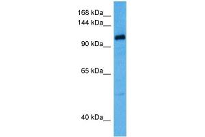 Host:  Rabbit  Target Name:  KCNQ5  Sample Tissue:  Human OVCAR-3 Whole Cell lysates  Antibody Dilution:  1ug/ml