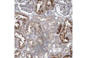 Immunohistochemical staining of human kidney with HEATR6 polyclonal antibody  shows strong cytoplasmic positivity in a subset of tubules. (HEATR6 anticorps)