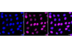Immunocytochemical staining of HT- cells with Sirtuin 6 antibody (ABIN7800356), 1:1,000).