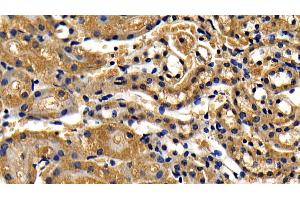 Detection of TICAM1 in Mouse Kidney Tissue using Polyclonal Antibody to Toll Like Receptor Adaptor Molecule 1 (TICAM1)