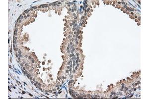 Immunohistochemical staining of paraffin-embedded Human pancreas tissue using anti-PFN1 mouse monoclonal antibody.