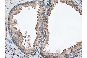 Immunohistochemical staining of paraffin-embedded Human pancreas tissue using anti-PFN1 mouse monoclonal antibody. (PFN1 anticorps)