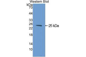 Western blot analysis of the recombinant protein. (C1QBP anticorps  (AA 72-279))