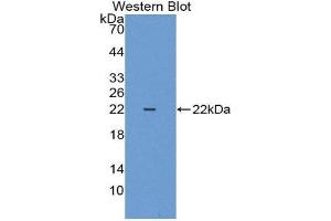 Western Blotting (WB) image for anti-Keratin 18 (KRT18) (AA 1-159) antibody (ABIN1862828) (Cytokeratin 18 anticorps  (AA 1-159))