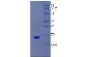 SDS-PAGE analysis of Mouse aZGP1 Protein. (AZGP1 Protéine)