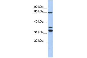 S100PBP antibody used at 1 ug/ml to detect target protein. (S100PBP anticorps  (Middle Region))