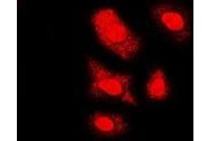 Immunofluorescent analysis of FKBP6 staining in U2OS cells. (FKBP6 anticorps)