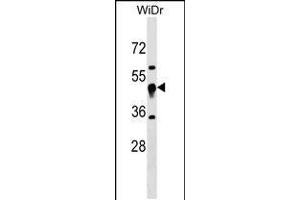 Western blot analysis in WiDr cell line lysates (35ug/lane). (UQCRC1 anticorps  (N-Term))