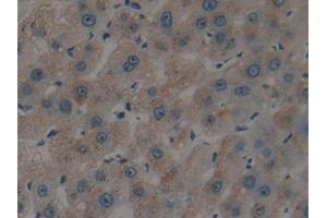 Detection of tPA in Human Liver Tissue using Polyclonal Antibody to Tissue Plasminogen Activator (tPA)