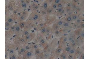 Detection of tPA in Human Liver Tissue using Polyclonal Antibody to Tissue Plasminogen Activator (tPA) (PLAT anticorps)