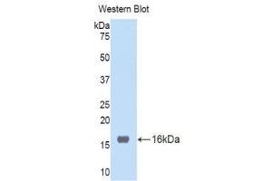 Western Blotting (WB) image for anti-Tumor Necrosis Factor Receptor Superfamily, Member 19 (TNFRSF19) (AA 41-161) antibody (ABIN1176207) (TNFRSF19 anticorps  (AA 41-161))