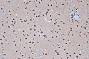 Immunohistochemistry of paraffin-embedded rat brain using HD Rabbit mAb (ABIN7267714) at dilution of 1:100 (40x lens).