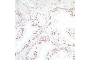 anti-CREB Regulated Transcription Coactivator 1 (CRTC1) (C-Term) antibody