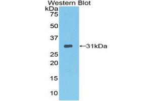 Western blot analysis of the recombinant protein. (Neurotrypsin anticorps  (AA 153-399))