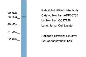 Western Blotting (WB) image for anti-Protein Kinase C, eta (PRKCH) (N-Term) antibody (ABIN2786852) (PKC eta anticorps  (N-Term))