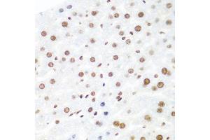 Immunohistochemistry of paraffin-embedded mouse liver using AGO2 antibody at dilution of 1:100 (40x lens). (AGO2 anticorps)