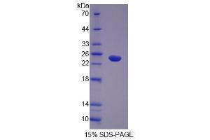 Image no. 1 for Abl-Interactor 1 (ABI1) (AA 1-182) protein (His tag) (ABIN6237271)
