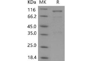 Western Blotting (WB) image for Sema Domain, Immunoglobulin Domain (Ig), Short Basic Domain, Secreted, (Semaphorin) 3A (SEMA3A) protein (Fc Tag) (ABIN7320211)