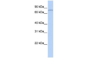 WB Suggested Anti-HDAC9 Antibody Titration:  0. (HDAC9 anticorps  (Middle Region))