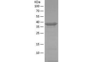 Western Blotting (WB) image for phosphofructokinase, Platelet (PFKP) (AA 436-784) protein (His tag) (ABIN7124409)