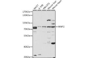 Western blot analysis of extracts of various cell lines, using MMP2 antibody (ABIN6129300, ABIN6143910, ABIN6143912 and ABIN6215078) at 1:3000 dilution. (MMP2 anticorps  (AA 40-280))