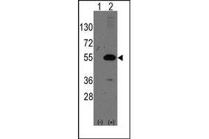 Image no. 1 for anti-Nuclear Receptor Subfamily 0, Group B, Member 1 (NR0B1) (N-Term) antibody (ABIN357833) (NR0B1 anticorps  (N-Term))