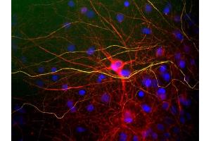 View of mixed neuron/glial cultures stained with NF-L / NEFL antibody (red) and rabbit antibody to phosphorylated NF-H (green). (NEFL anticorps)