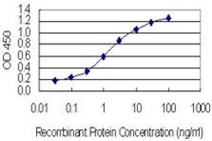 Detection limit for recombinant GST tagged RIC8A is 0. (RIC8A anticorps  (AA 462-534))