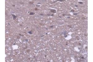 DAB staining on IHC-P; Samples: Rat Spinal cord Tissue
