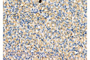 ABIN6259594 and ABIN6274739 at 1/100 staining Mouse kidney tissue by IHC-P.